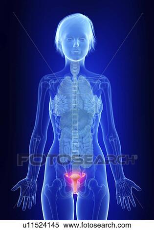 Illustration of an inflamed uterus. View Large Photo Image Stock Photography - Illustration of an inflamed uterus.. Fotosearch