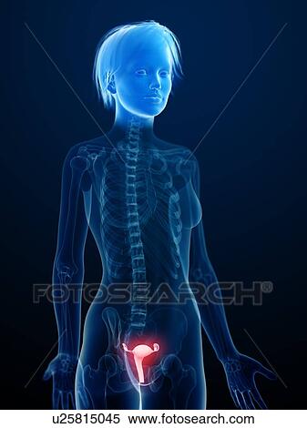 Stock Photography - Illustration of an inflamed uterus.. Fotosearch