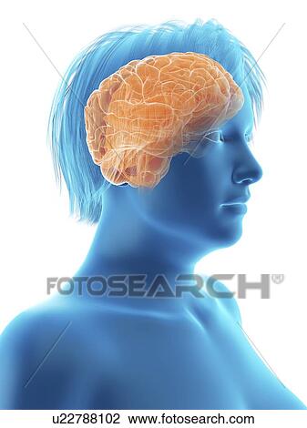 Stock Image - Illustration of an obese woman's brain.. Fotosearch