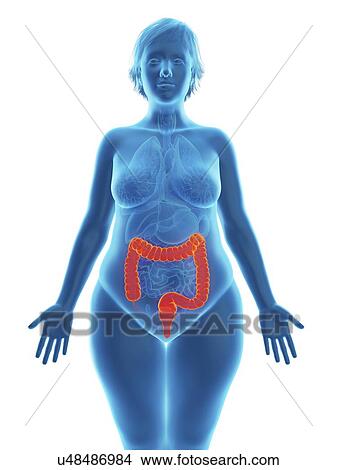 Picture - Illustration of an obese woman's colon.. Fotosearch