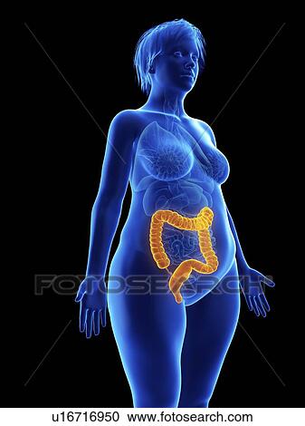 Stock Image - Illustration of an obese woman's colon.. Fotosearch