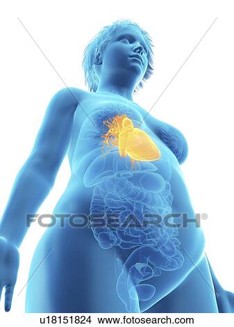 Picture - Illustration of an obese woman's heart.. Fotosearch