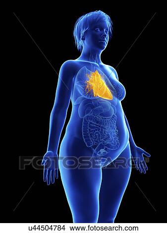 Picture - Illustration of an obese woman's heart.. Fotosearch