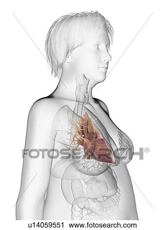 Stock Image - Illustration of an obese woman's heart.. Fotosearch