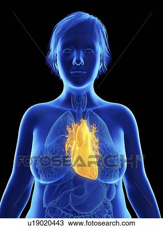 Stock Image - Illustration of an obese woman's heart.. Fotosearch
