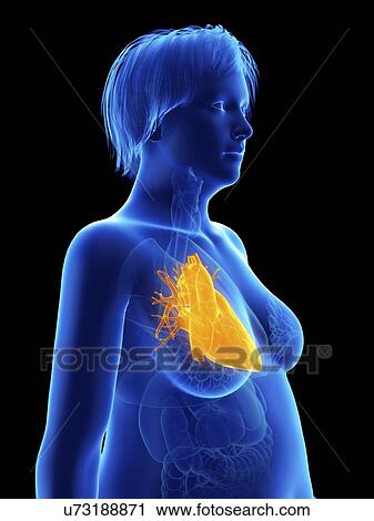 Stock Image - Illustration of an obese woman's heart.. Fotosearch