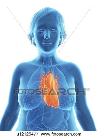 Stock Photo - Illustration of an obese woman's heart.. Fotosearch