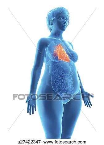 Stock Photo - Illustration of an obese woman's heart.. Fotosearch