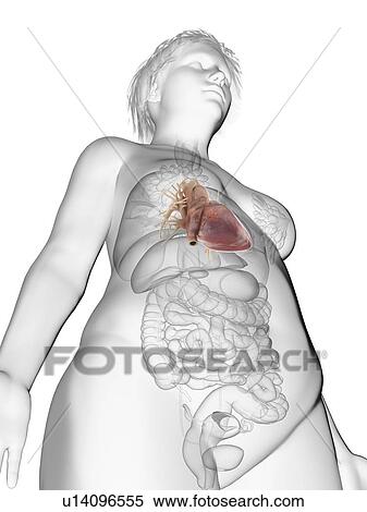 Illustration of an obese woman's heart. View Large Photo Image Stock Photography - Illustration of an obese woman's heart.. Fotosearch