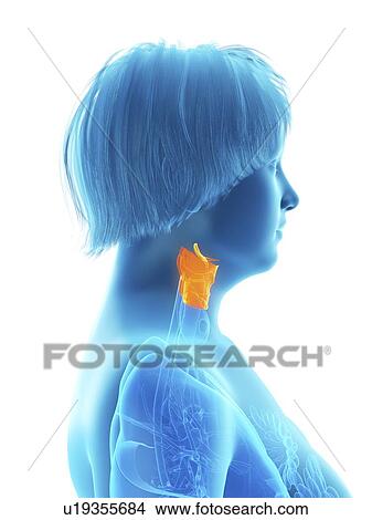 Picture - Illustration of an obese woman's larynx.. Fotosearch