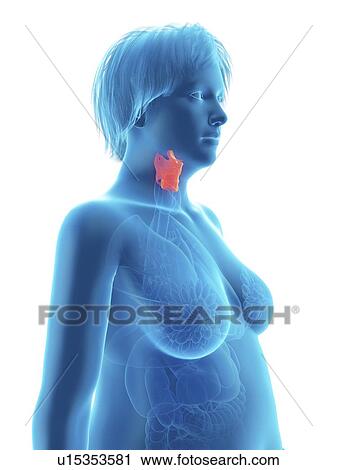 Stock Image - Illustration of an obese woman's larynx.. Fotosearch