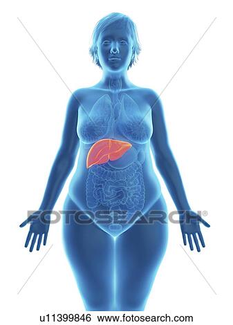 Illustration of an obese woman's liver. View Large Photo Image Stock Photograph - Illustration of an obese woman's liver.. Fotosearch