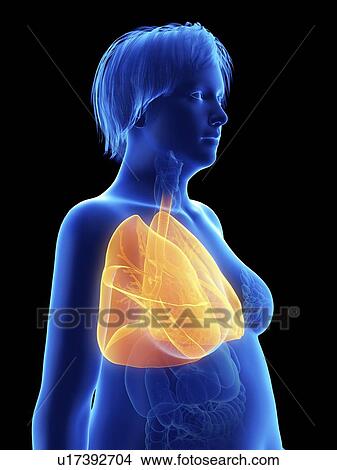 Picture - Illustration of an obese woman's lung.. Fotosearch