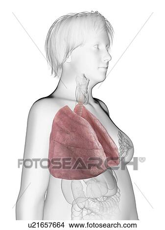 Picture - Illustration of an obese woman's lung.. Fotosearch