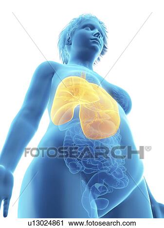 Stock Image - Illustration of an obese woman's lung.. Fotosearch