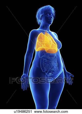 Illustration of an obese woman's lung. View Large Photo Image Stock Image - Illustration of an obese woman's lung.. Fotosearch