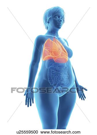 Stock Image - Illustration of an obese woman's lung.. Fotosearch