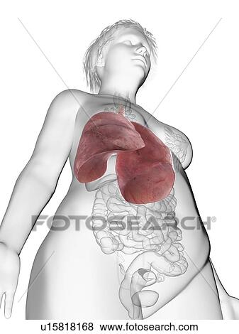 Stock Photo - Illustration of an obese woman's lung.. Fotosearch