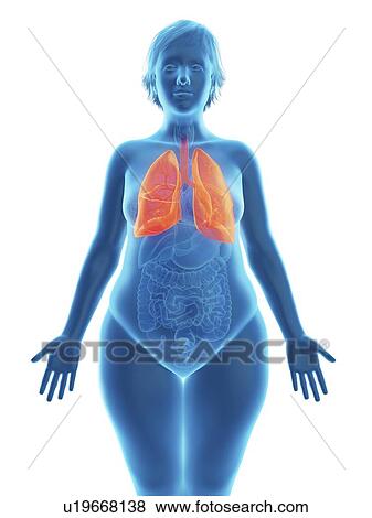 Stock Photo - Illustration of an obese woman's lung.. Fotosearch