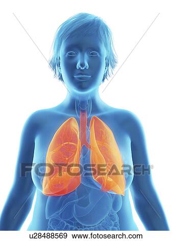 Stock Photo - Illustration of an obese woman's lung.. Fotosearch