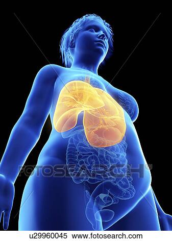 Stock Photography - Illustration of an obese woman's lung.. Fotosearch