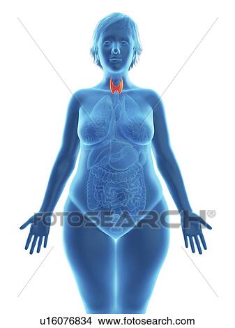 Picture - Illustration of an obese woman's thyroid gland.. Fotosearch