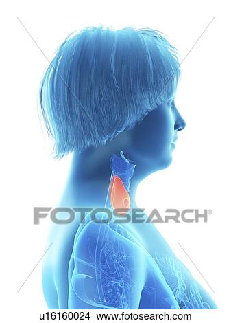 Picture - Illustration of an obese woman's thyroid gland.. Fotosearch