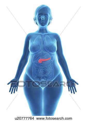 Picture - Illustration of an obese woman's pancreas.. Fotosearch