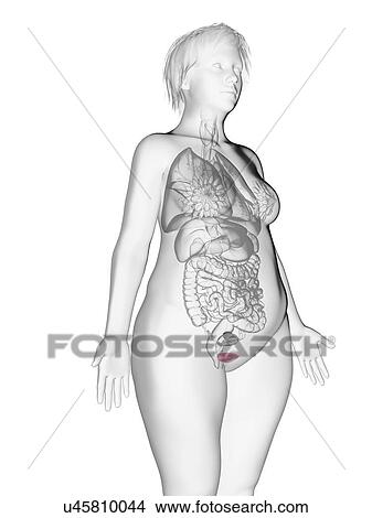 Picture - Illustration of an obese woman's bladder.. Fotosearch