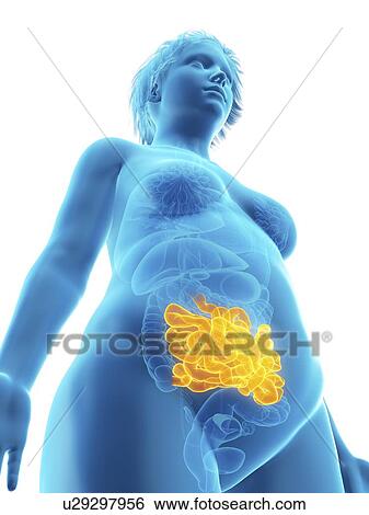Stock Photograph - Illustration of an obese woman's small intestine.. Fotosearch