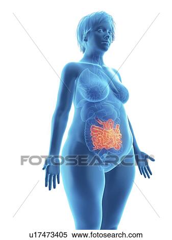 Stock Photography - Illustration of an obese woman's small intestine.. Fotosearch