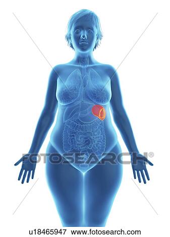 Stock Photo - Illustration of an obese woman's spleen.. Fotosearch