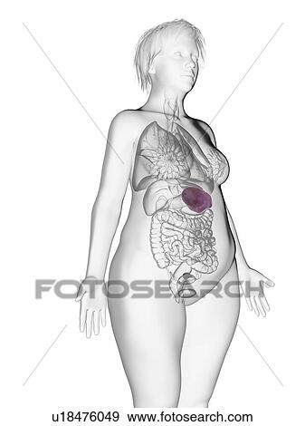 Illustration of an obese woman's spleen. View Large Photo Image Stock Photo - Illustration of an obese woman's spleen.. Fotosearch