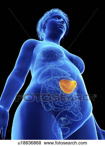 Stock Photo - Illustration of an obese woman's spleen.. Fotosearch