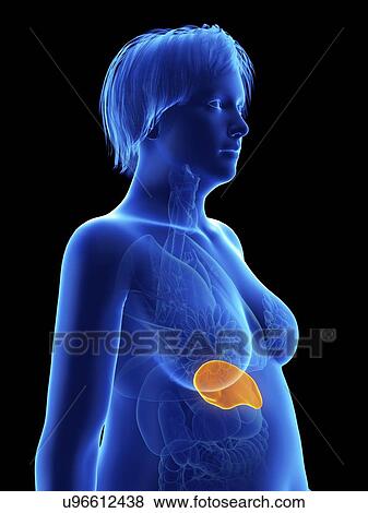 Stock Photo - Illustration of an obese woman's spleen.. Fotosearch