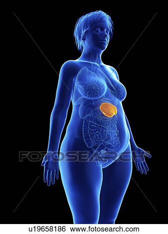 Stock Photograph - Illustration of an obese woman's spleen.. Fotosearch