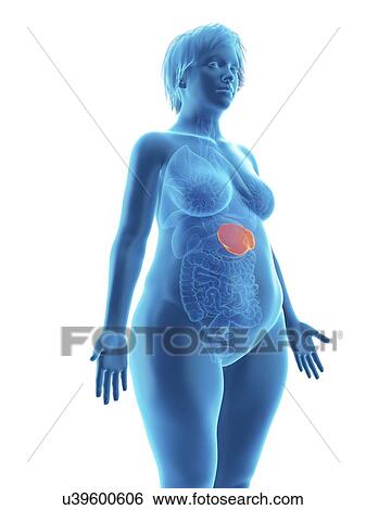 Stock Photograph - Illustration of an obese woman's spleen.. Fotosearch