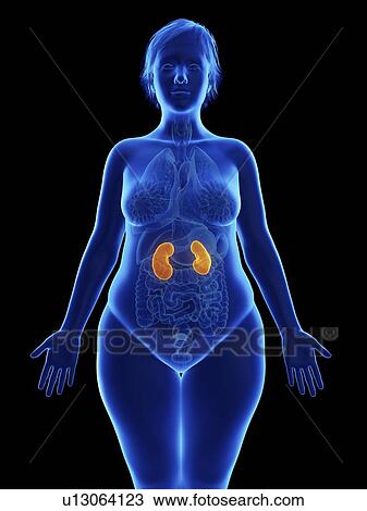 Stock Image - Illustration of an obese woman's kidneys.. Fotosearch