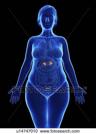 Stock Image - Illustration of an obese woman's adrenal glands.. Fotosearch