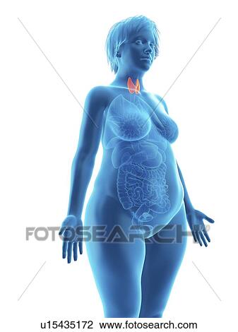 Stock Image - Illustration of an obese woman's thyroid gland.. Fotosearch