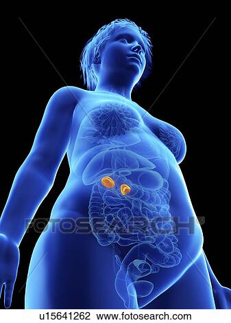 Stock Image - Illustration of an obese woman's adrenal glands.. Fotosearch