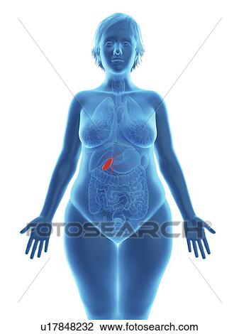Stock Image - Illustration of an obese woman's gallbladder.. Fotosearch