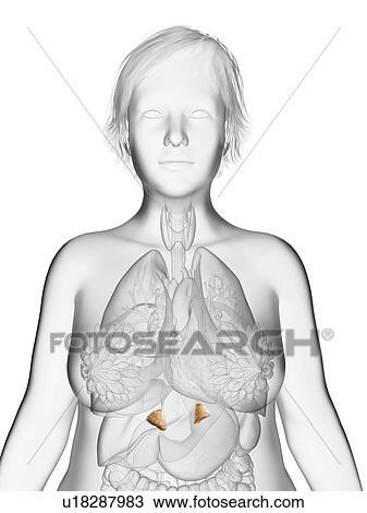 Stock Image - Illustration of an obese woman's adrenal glands.. Fotosearch