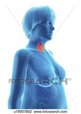 Stock Image - Illustration of an obese woman's thyroid gland.. Fotosearch