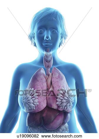 Stock Image - Illustration of an obese woman's internal organs.. Fotosearch