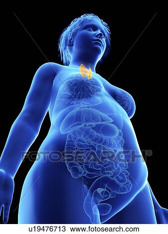 Illustration of an obese woman's thyroid gland. View Large Photo Image Stock Image - Illustration of an obese woman's thyroid gland.. Fotosearch