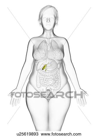Stock Image - Illustration of an obese woman's gallbladder.. Fotosearch