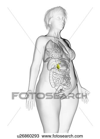 Stock Image - Illustration of an obese woman's gallbladder.. Fotosearch