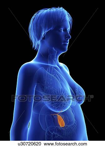 Stock Image - Illustration of an obese woman's gallbladder.. Fotosearch