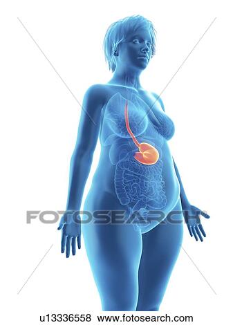 Stock Photo - Illustration of an obese woman's stomach.. Fotosearch